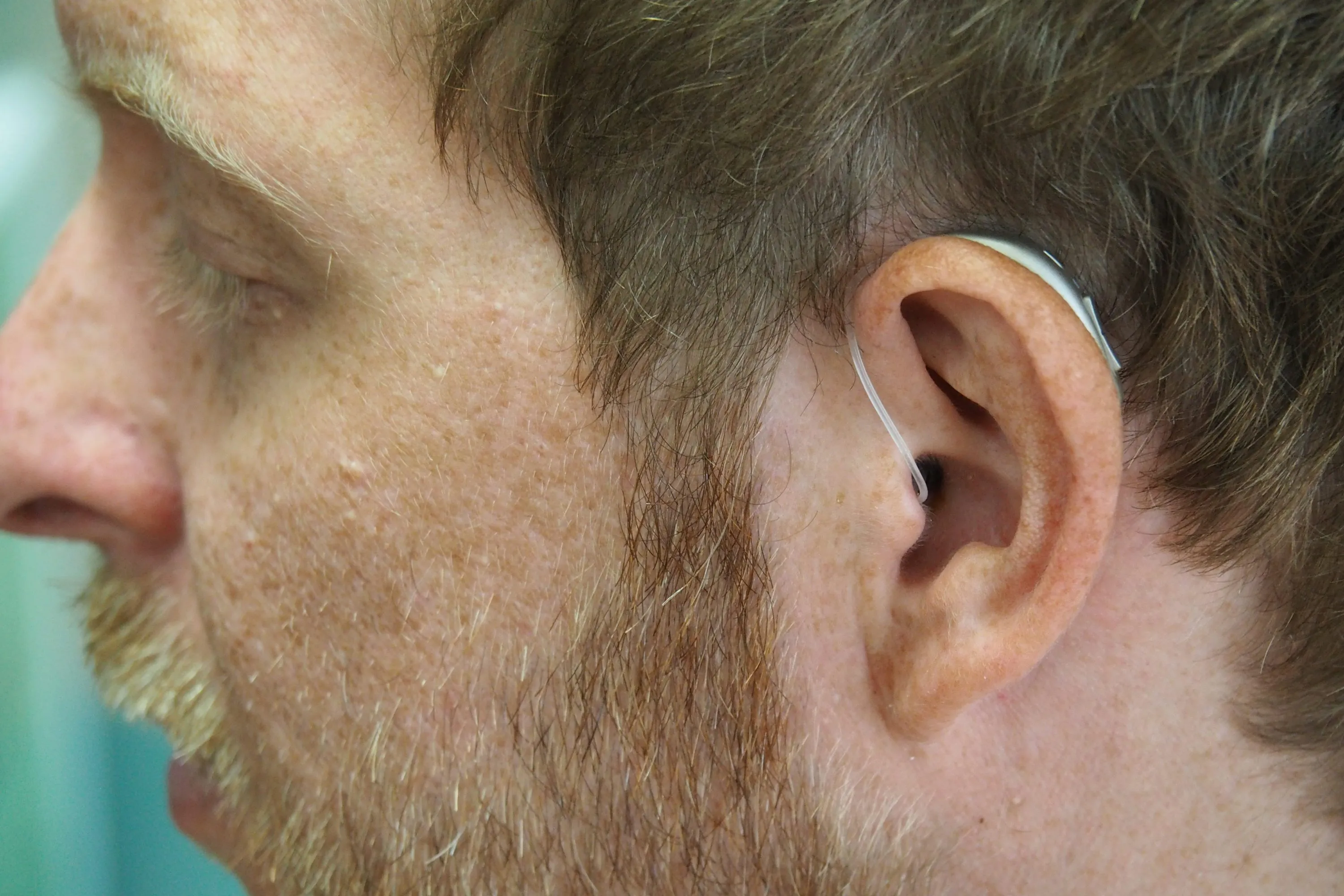 A man wearing a Bluetooth-capable hearing aid